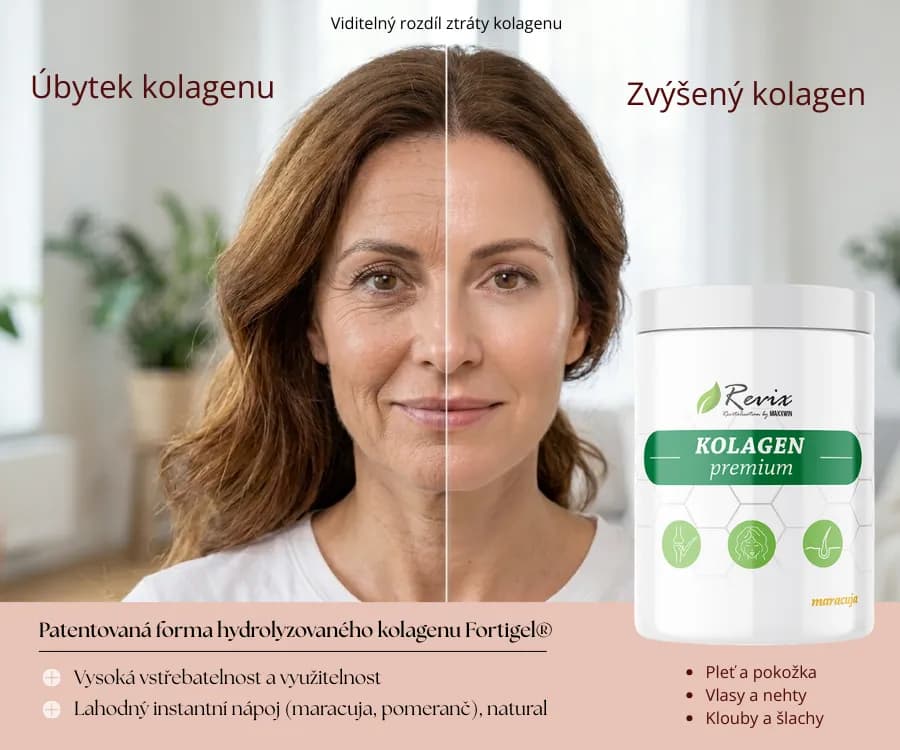 REVIX KOLAGEN PREMIUM maracuja 250 g - náhled 3